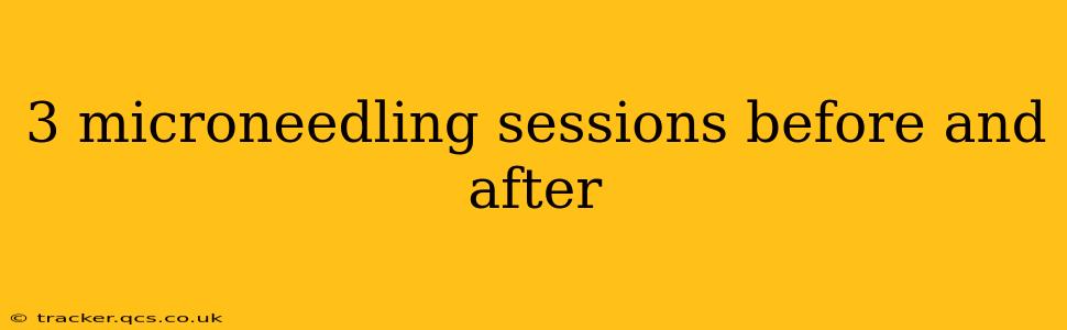 3 microneedling sessions before and after