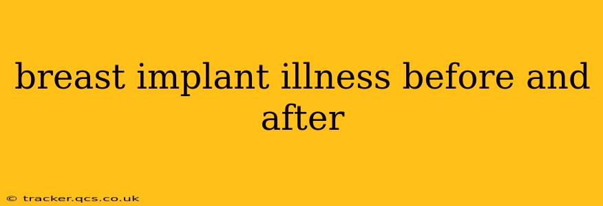breast implant illness before and after