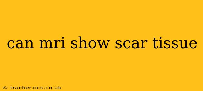 can mri show scar tissue