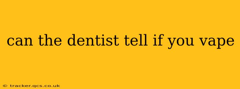 can the dentist tell if you vape