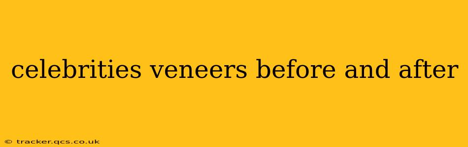 celebrities veneers before and after