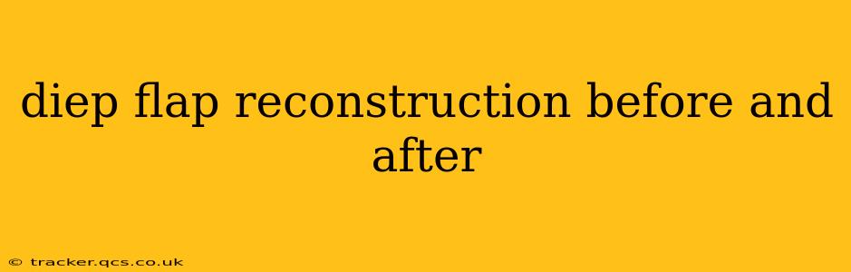 diep flap reconstruction before and after