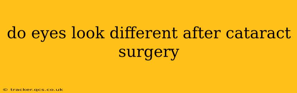 do eyes look different after cataract surgery