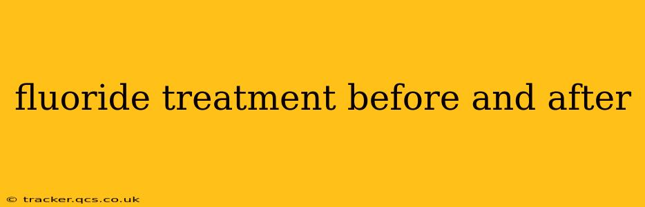 fluoride treatment before and after