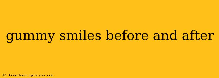 gummy smiles before and after