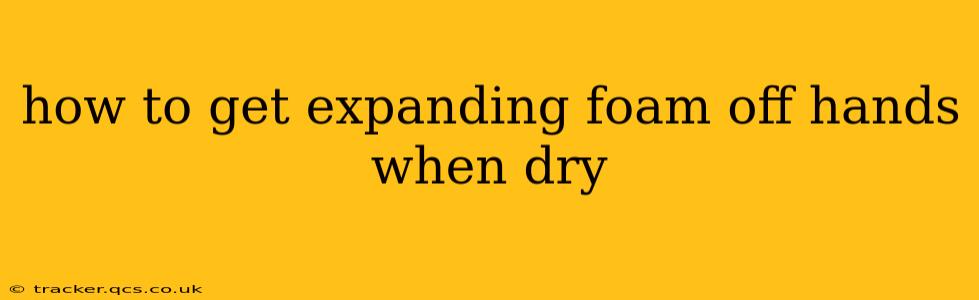 how to get expanding foam off hands when dry