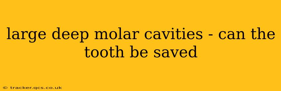 large deep molar cavities - can the tooth be saved