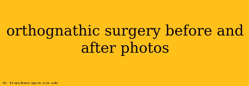 orthognathic surgery before and after photos