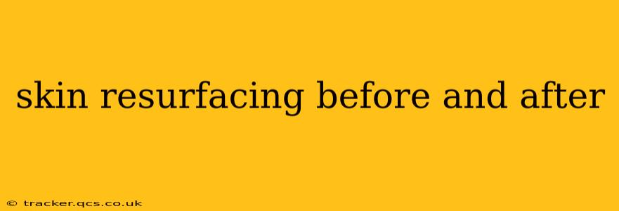 skin resurfacing before and after