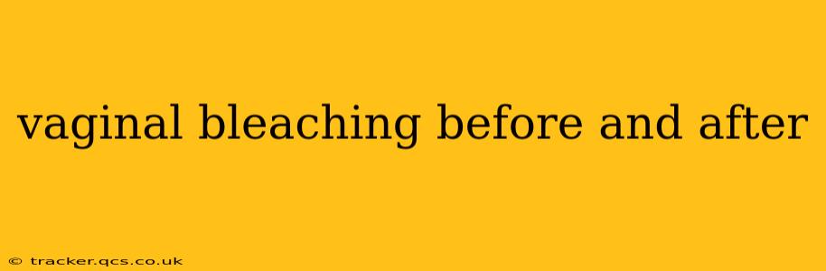 vaginal bleaching before and after