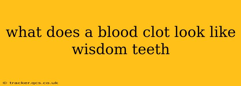 what does a blood clot look like wisdom teeth