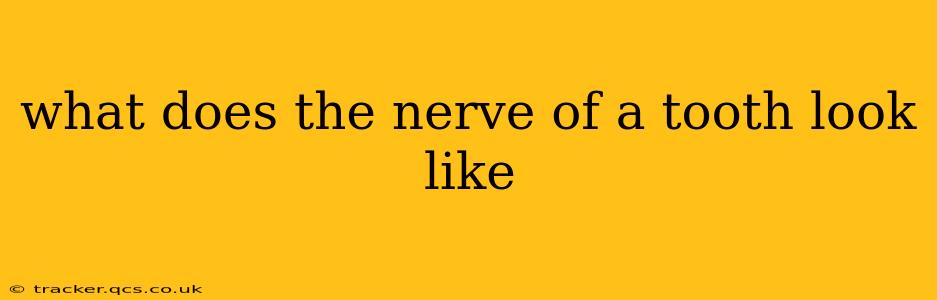 what does the nerve of a tooth look like