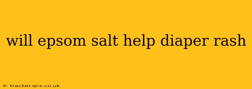 will epsom salt help diaper rash