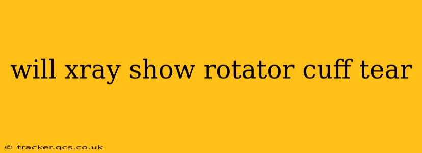 will xray show rotator cuff tear